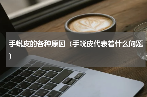 手蜕皮的各种原因（手蜕皮代表着什么问题）
