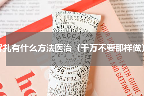 蜂扎有什么方法医治（千万不要那样做）