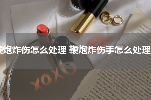 鞭炮炸伤怎么处理 鞭炮炸伤手怎么处理