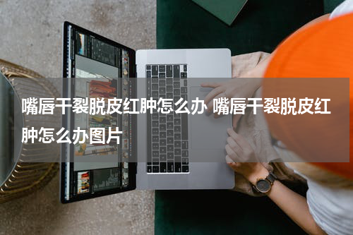 嘴唇干裂脱皮红肿怎么办 嘴唇干裂脱皮红肿怎么办图片