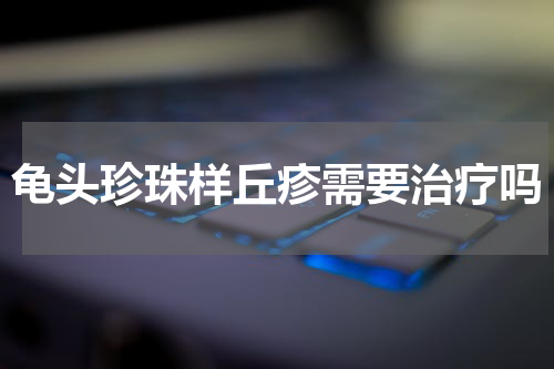 龟头珍珠样丘疹需要治疗吗